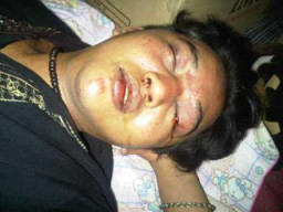 Polsek Sawahan Enggan Tangani Korban Pengeroyokan